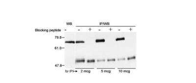 Immunoprecipitation: Menin Antibody [Biotin] [NBP1-71794] -  Whole cell lysate (40 ug forWB; one 10 cm plate HEK293T cells for IP) from 293T cells. Antibodies: Affinity purified goat anti-Menin used as indicated for IP. Menin was detected by western blot using affinity purified rabbit anti-Menin at0.1 ug/ml for WB. Detection: Chemiluminescence exposed for 1 minute.